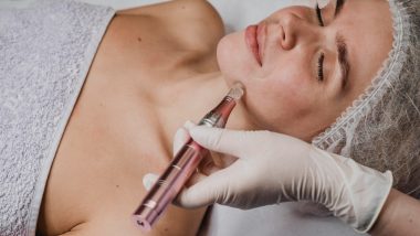 Exosome-enhanced microneedling in Beverly Hills: A smart add-on for smoother, brighter skin