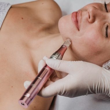 Exosome-enhanced microneedling in Beverly Hills: A smart add-on for smoother, brighter skin
